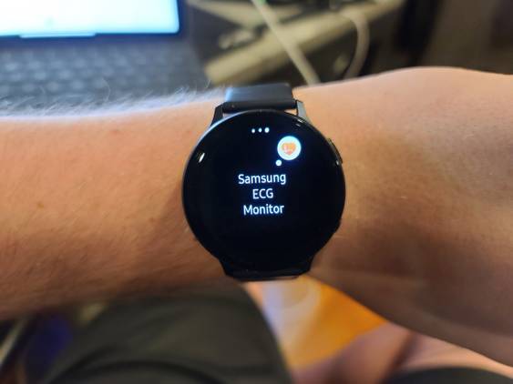 Samsung Galaxy Watch Active 2 ECG monitoring