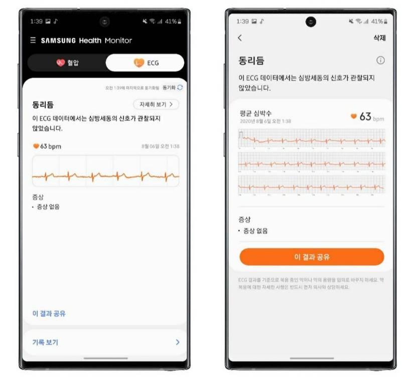 Samsung Galaxy Watch Active 2 ECG app function