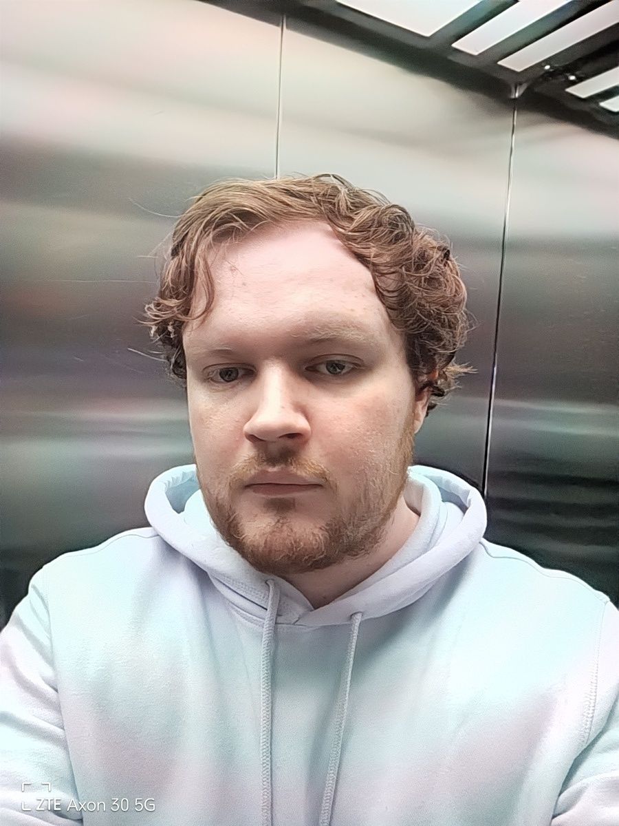 Front-facing camera of the ZTE Axon 30