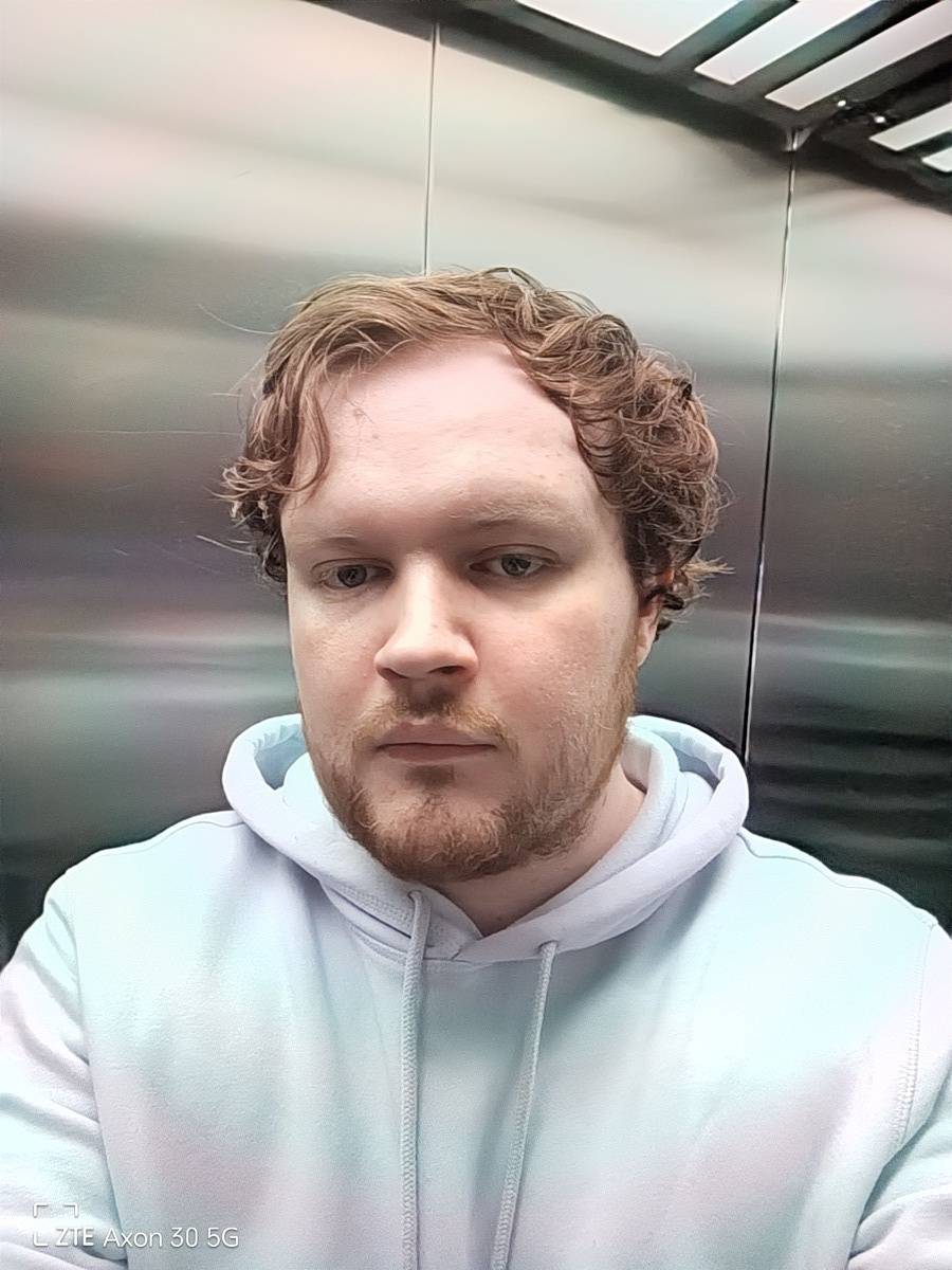 Front-facing camera of the ZTE Axon 30