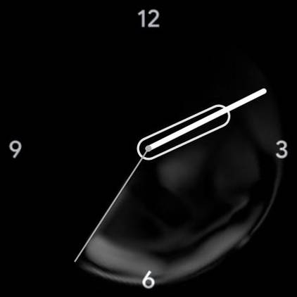 Ink Pixel Watch watch face