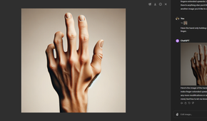 The result of the index finger request