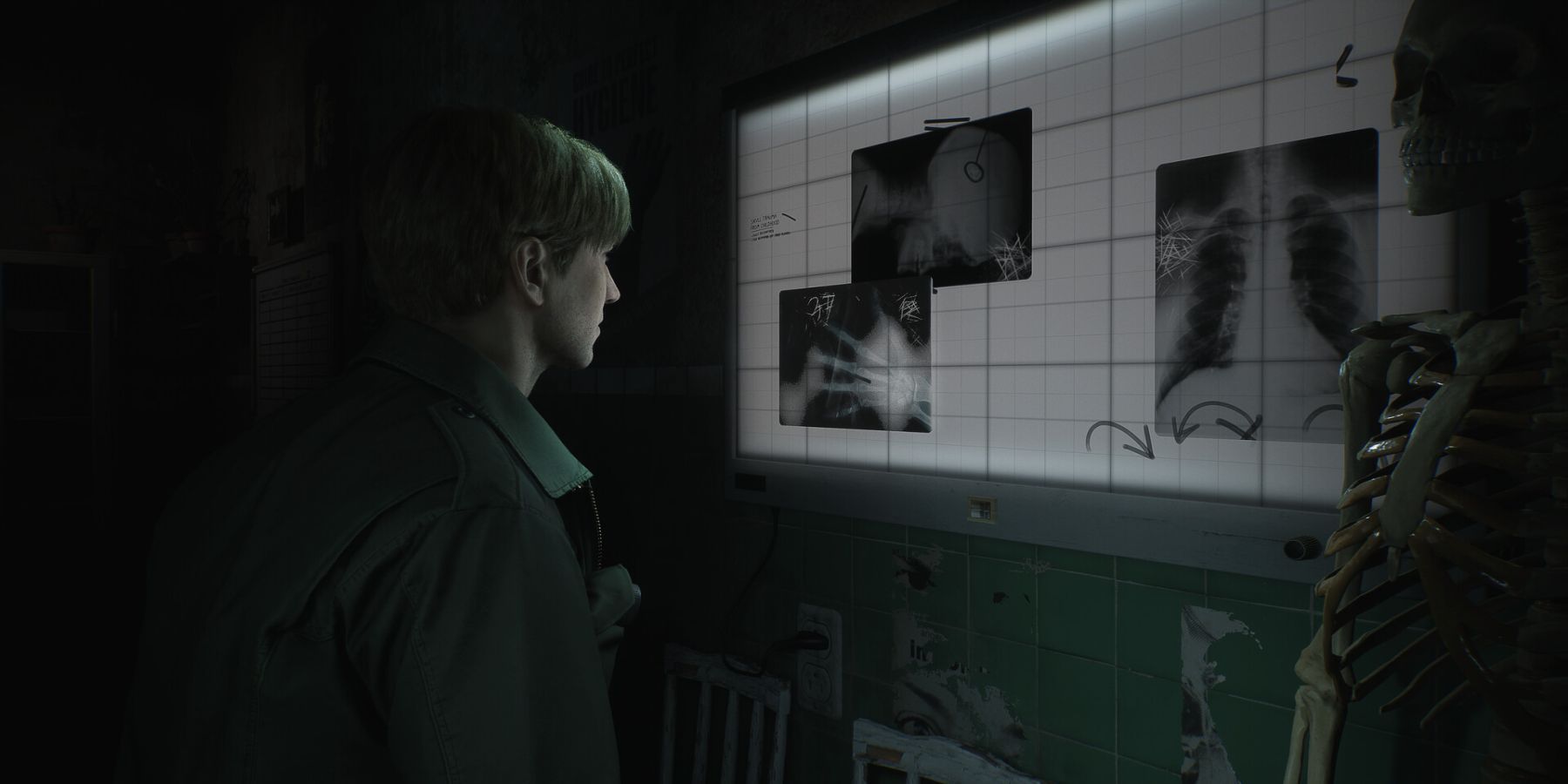 James looking at an x-ray in a hospital room