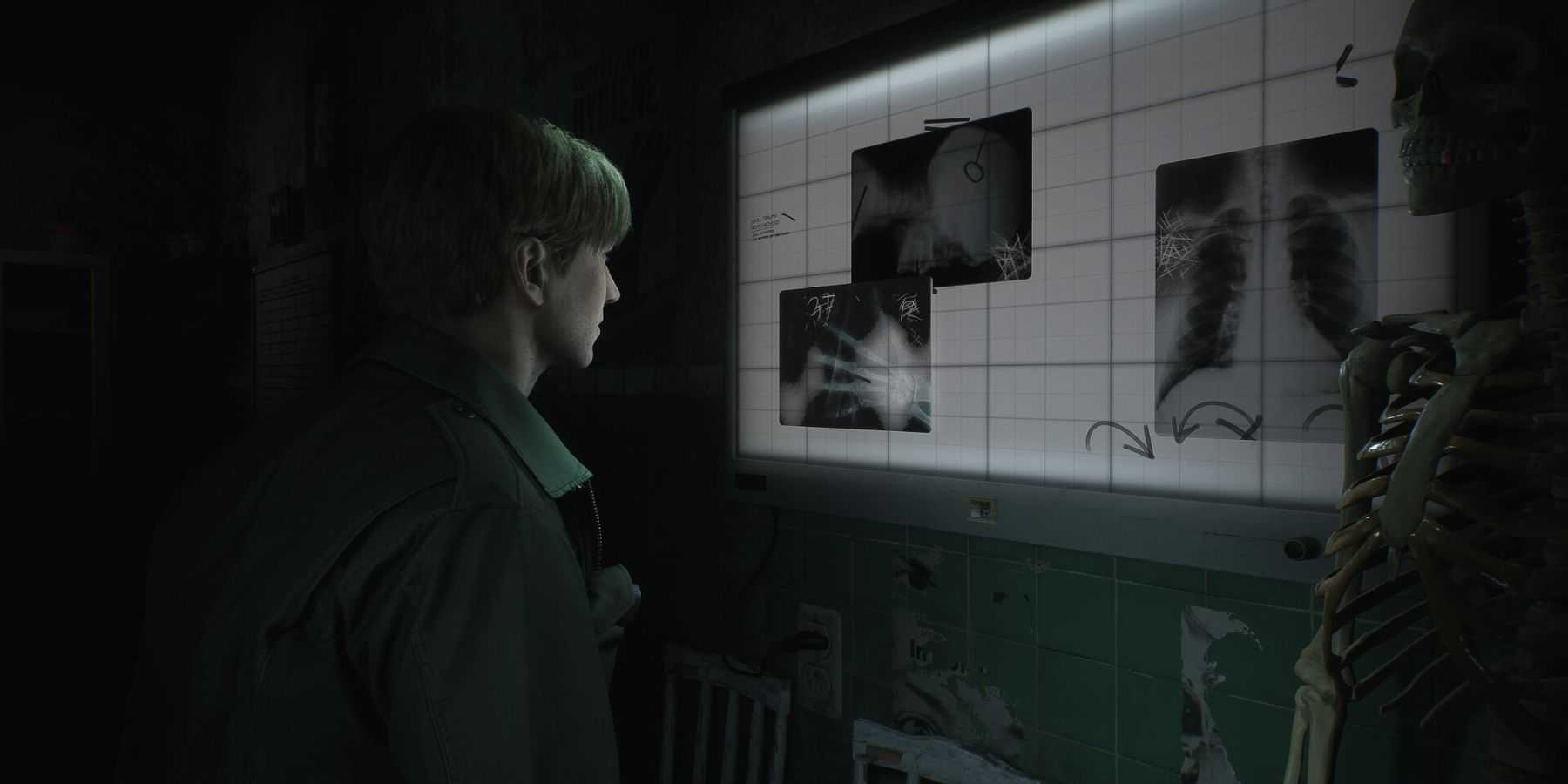 James looking at an x-ray in a hospital room