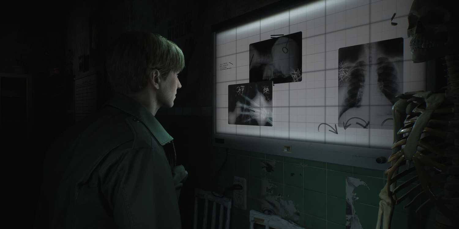 James looking at an x-ray in a hospital room