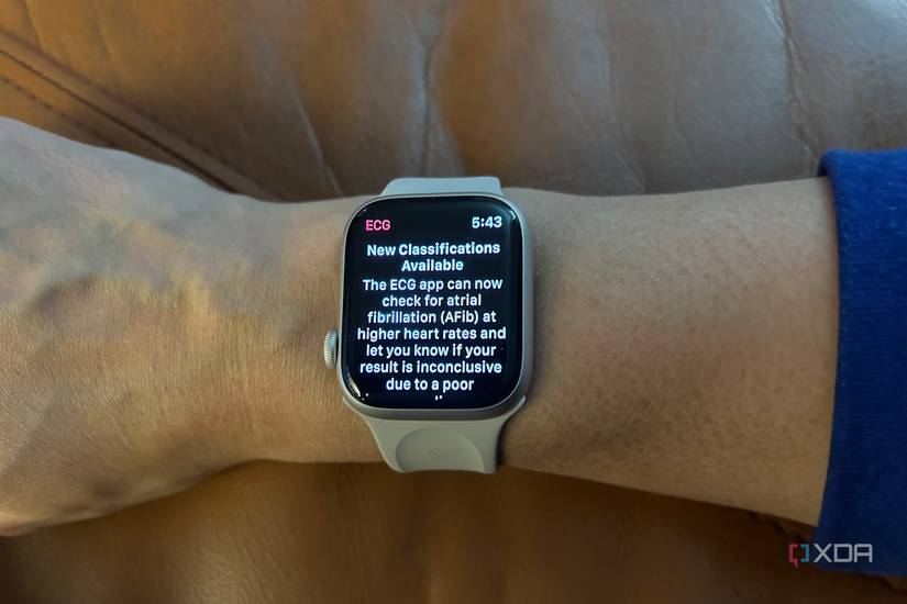 Apple Watch ECG sensor placement correct fit