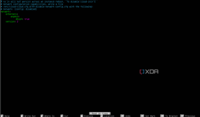 A screenshot of Ubuntu's default network configuration file.