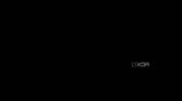 Screenshot showing where to configure DHCP on an iPhone