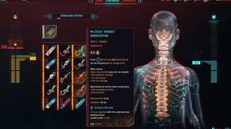 An image from Cyberpunk 2077, showing the body-augmentation screen.